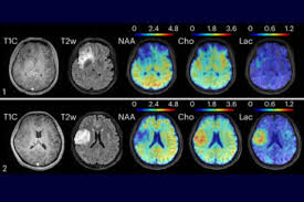 MRI scan showing 10 brain images progressing from black and white to colored.