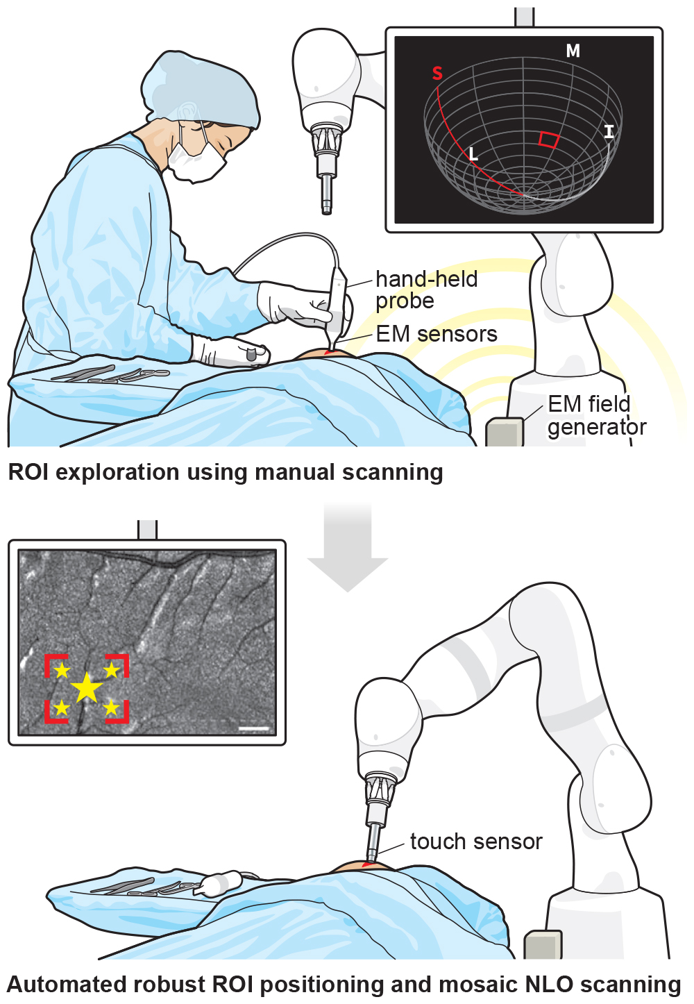 A two part figure showing the MarginDx system. A. a surgeon holding a probe scans a tumor cavity. B. a robotic arm returns to scan and classify tissue within the tumor cavity using AI.