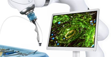 A handheld probe mounted to a surgical robotic arm with monitor displaying microscopy image of breast tissue. Text: Here is the MarginDx platform